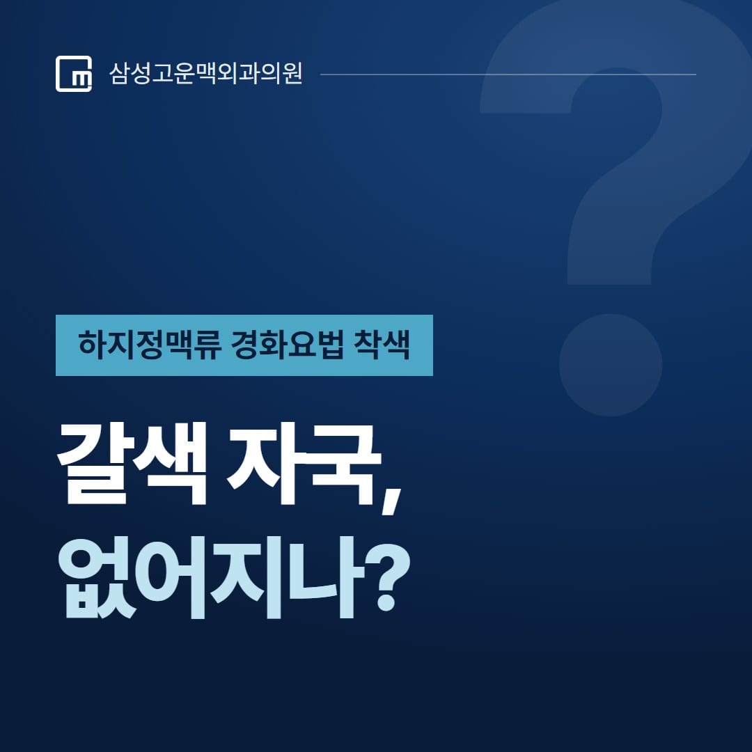 하지정맥류 경화요법 착색, 갈색 자국은 없어질까? — 삼성고운맥외과의원