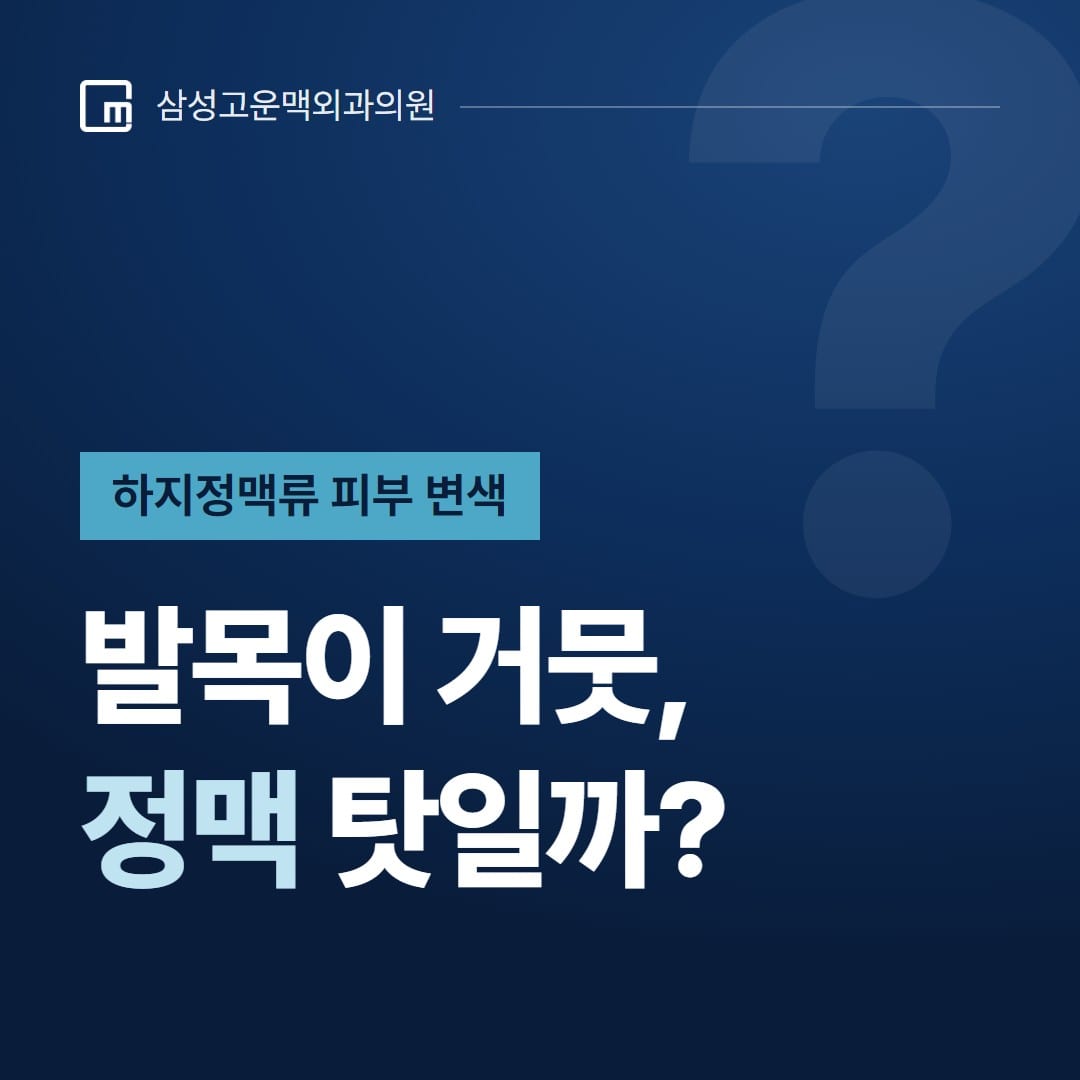 하지정맥류 피부 변색, 발목이 거뭇한 게 정맥 탓일까? — 삼성고운맥외과의원